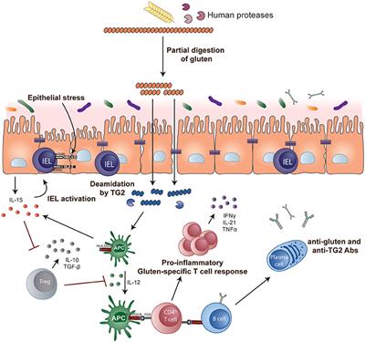 Frontiers | Celiac Disease: A Review Of Current Concepts In ...